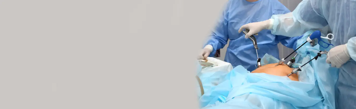 Educational illustration for laparoscopic (minimally invasive) surgery discussion in Kompally