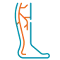 varicose vein