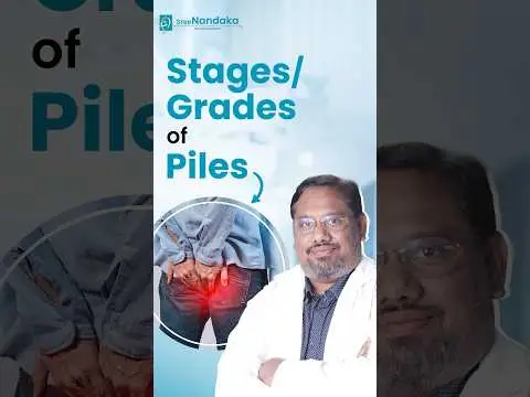 Stages/Grades of Piles in Telugu | Best Piles Doctor in Hyderabad | Dr. Praveen Koduru